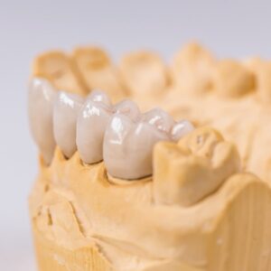 Dental Implants in Chester Country