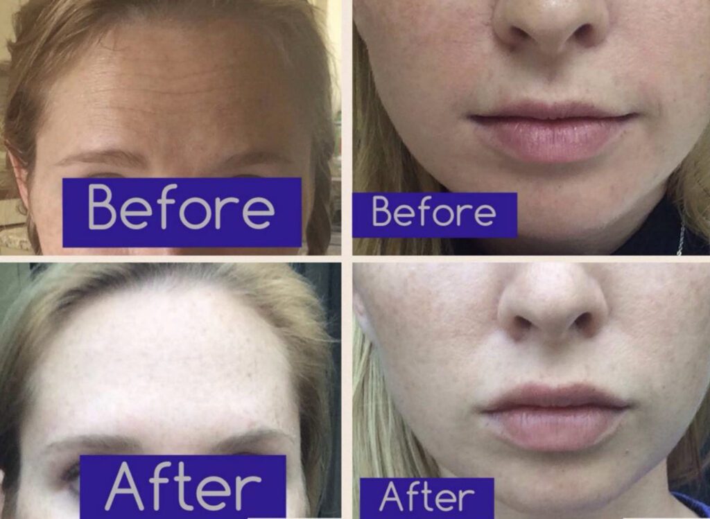 before&after